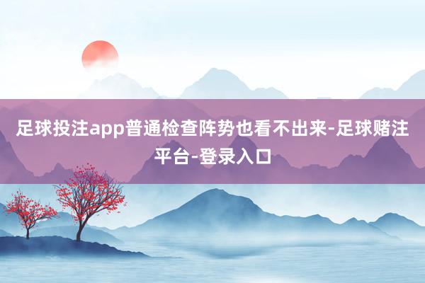 足球投注app普通检查阵势也看不出来-足球赌注平台-登录入口